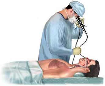ambulatorio di endoscopia bronchiale